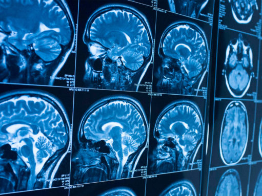 Bridging neuroscience of consciousness and education: Part I