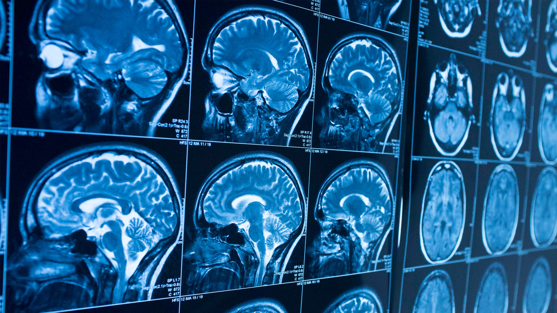 Bridging neuroscience of consciousness and education: Part I