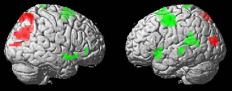 Mediamath Brain Visualization IBE — Science of learning portal — How does the brain learn simple ...