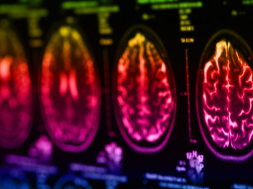 Poverty and neuroethical implications for teaching, inclusion, and educational practices