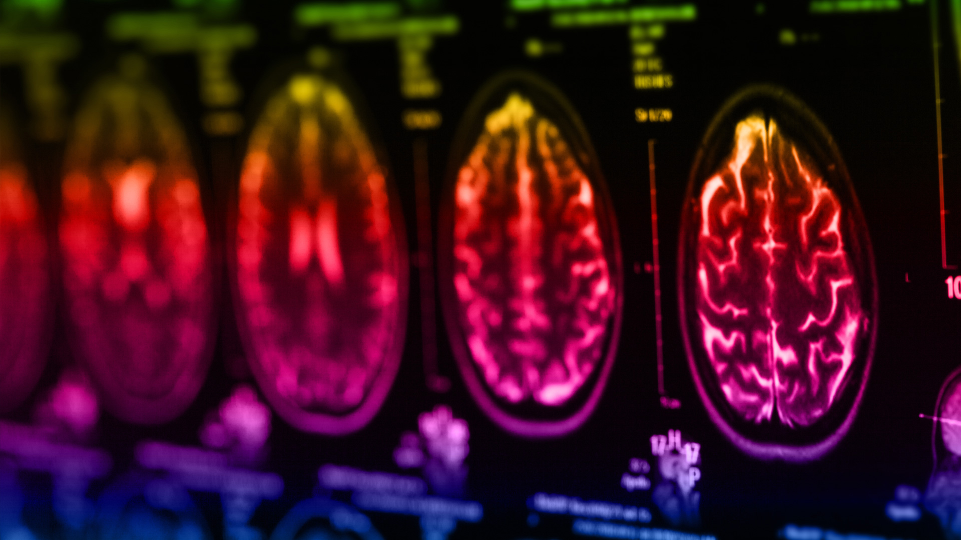 Poverty and neuroethical implications for teaching, inclusion, and educational practices